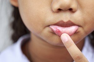 Conheça as causas das infecções bucais e os diferentes tipos de problemas que elas provocam.
