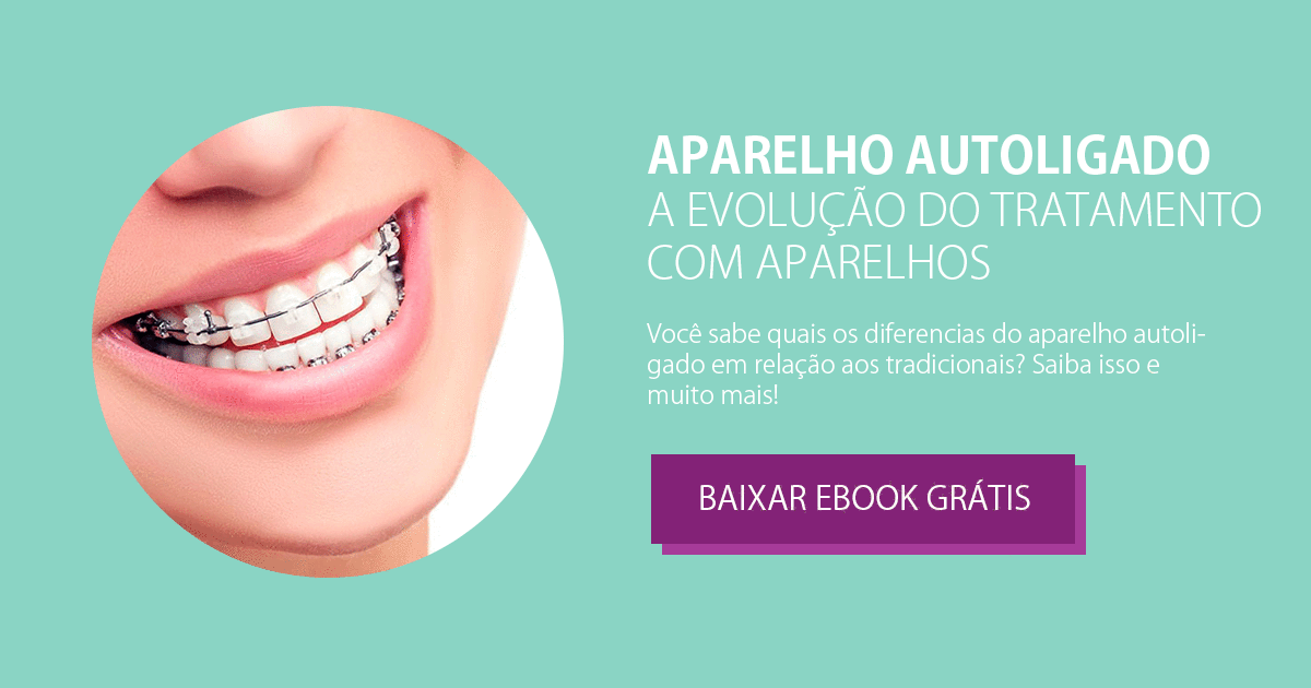 Baixe o eBook Aparelho Autoligado