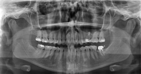 Conquist Odontologia Clareamento dental, Estética, Implantes
